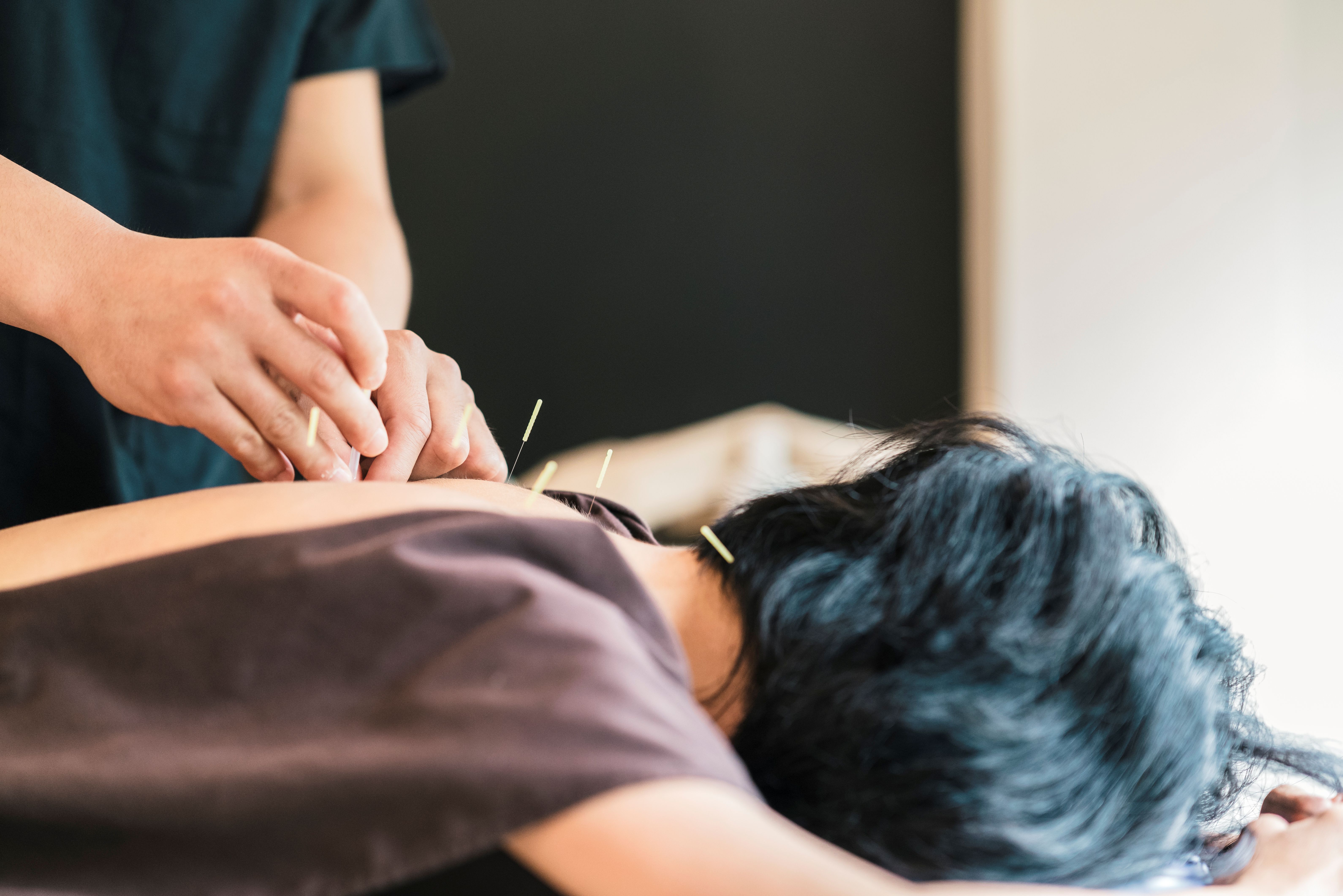 Acupuncture for Mental Health: Integrating Care